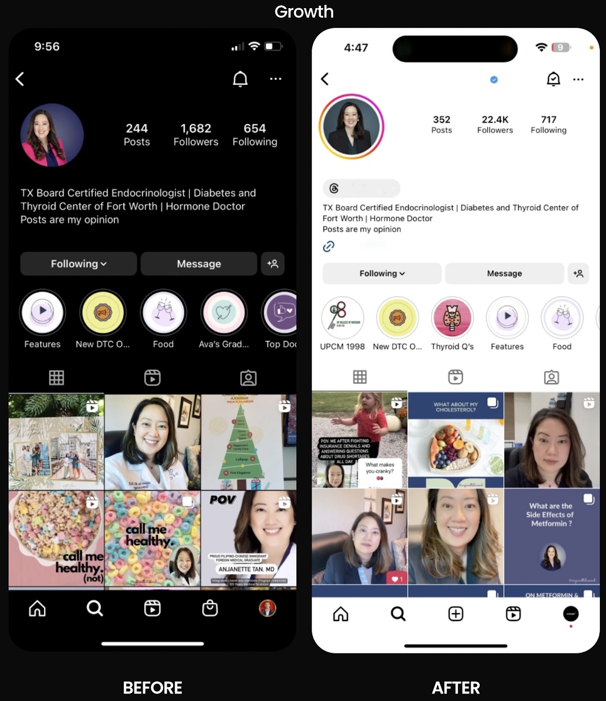 Doctor / medical Instagram growth case study